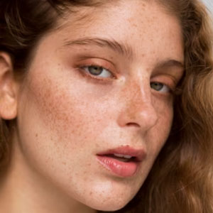 uneven-skin-textures-and-tone